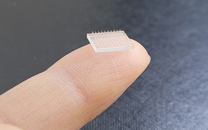 Miếng dán vi kim 3D vaccine COVID-19, giải pháp tiêm chủng mới