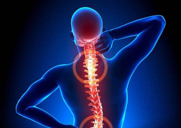 Hẹp ống sống - dấu hiệu, nguyên nhân, phương pháp chẩn đoán - Ảnh 1.