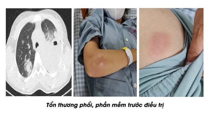  - Ảnh 1.