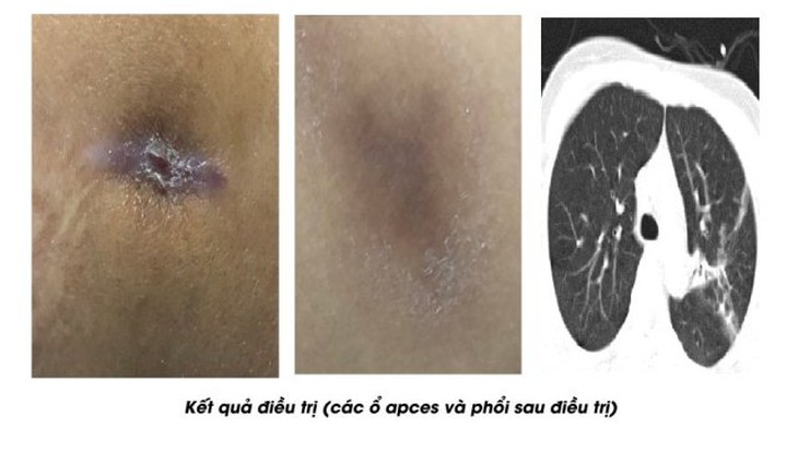  - Ảnh 2.