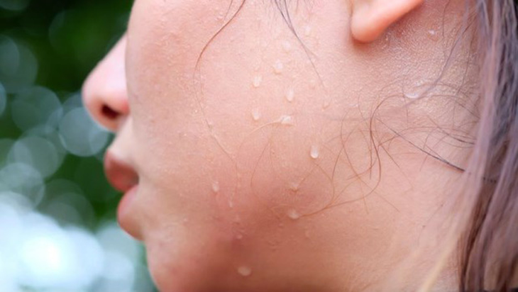 Basedow có nguy hiểm không? Làm sao để cải thiện bệnh? - Ảnh 1.