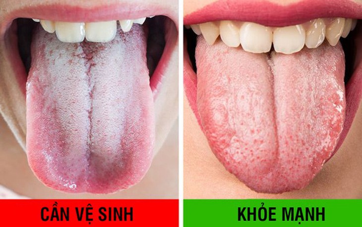 Đánh răng thôi chưa đủ, làm thêm 10 mẹo này giúp bạn có hàm răng chắc khỏe - Ảnh 10.