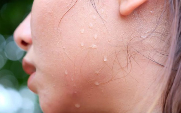 Basedow có nguy hiểm không? Làm sao để cải thiện bệnh?