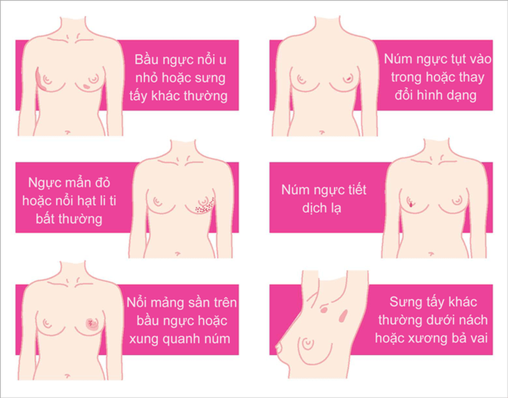 Thứ trưởng Bộ Y tế kêu gọi chị em khám sàng lọc căn bệnh ung thư gây ra hơn 15.000 ca mắc mỗi năm - Ảnh 4. Thứ trưởng Bộ Y tế kêu gọi chị em khám sàng lọc căn bệnh ung thư gây ra hơn 15.000 ca mắc mỗi năm - Ảnh 4.