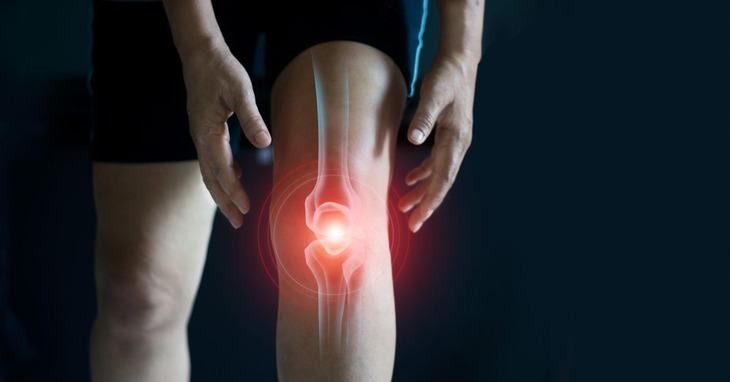 Những loại thuốc người bệnh viêm khớp cần biết - Ảnh 1.