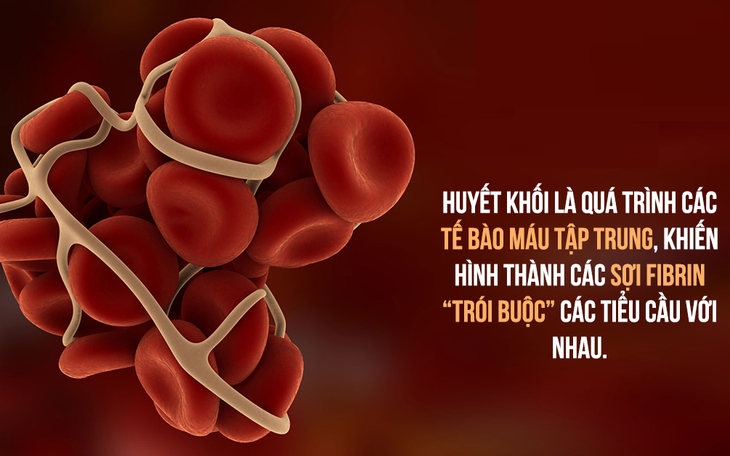 Cục máu đông tăng nguy cơ đột quỵ - Ăn gì để ngừa tắc mạch?
