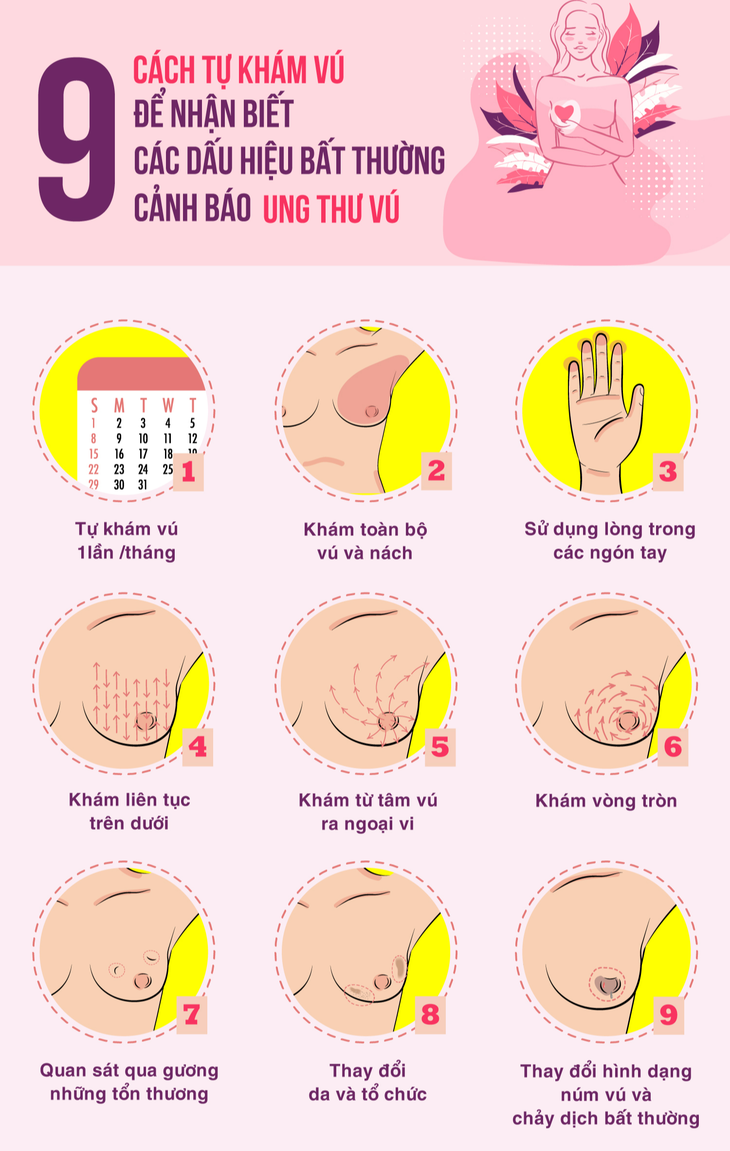 Ung thư vú  - Nguyên nhân, dấu hiệu nhận biết và cách tầm soát - Ảnh 4.