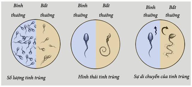 Dấu hiệu vô sinh ở nữ giới và nam giới - Ảnh 3.