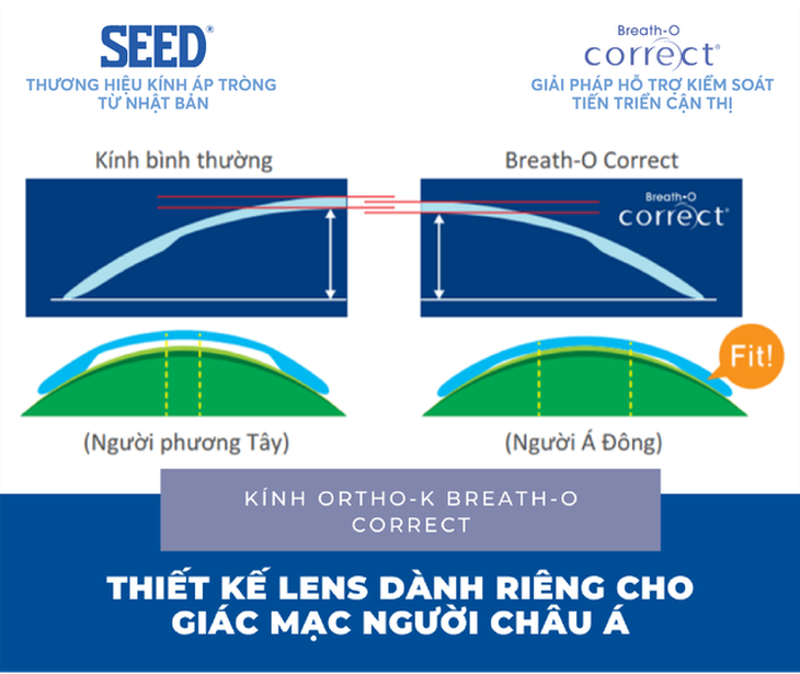  Điều chỉnh cận thị, hạn chế tăng độ không phẫu thuật qua giấc ngủ - Ảnh 5.