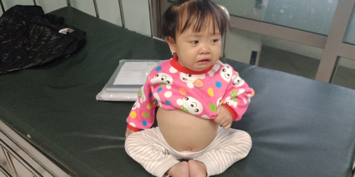 Sự sống mong manh của bé gái bụng to như trống vì bệnh hiểm nghèo - Ảnh 1. Sự sống mong manh của bé gái bụng to như trống vì bệnh hiểm nghèo - Ảnh 1.