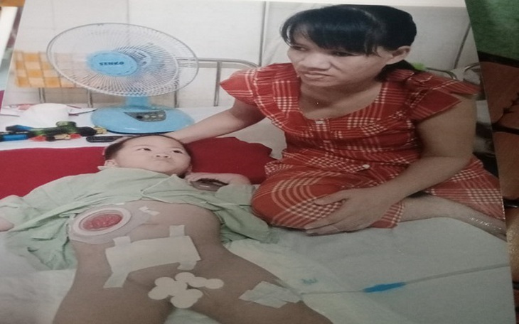 Xót xa nữ công nhân nghèo có con bị dị tật không hậu môn ở Thừa Thiên Huế - Ảnh 3. Xót xa nữ công nhân nghèo có con bị dị tật không hậu môn ở Thừa Thiên Huế - Ảnh 3.
