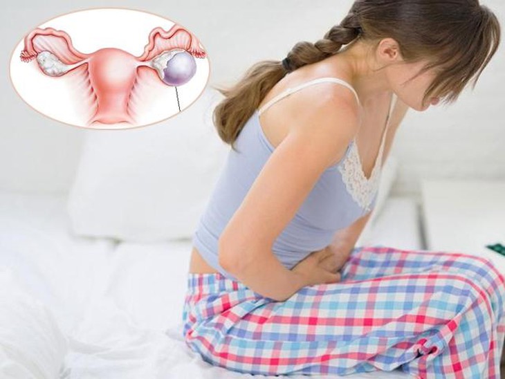 Buồng trứng đa nang là bệnh gây ra bởi tình trạng rối loạn nội tiết và là một trong những nguyên nhân thường gặp gây vô sinh sinh. Buồng trứng đa nang là bệnh gây ra bởi tình trạng rối loạn nội tiết và là một trong những nguyên nhân thường gặp gây vô sinh sinh.