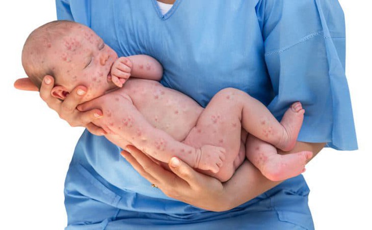 Tại sao phụ nữ cần tiêm vaccine phòng bệnh trước và trong thai kỳ? - Ảnh 5.