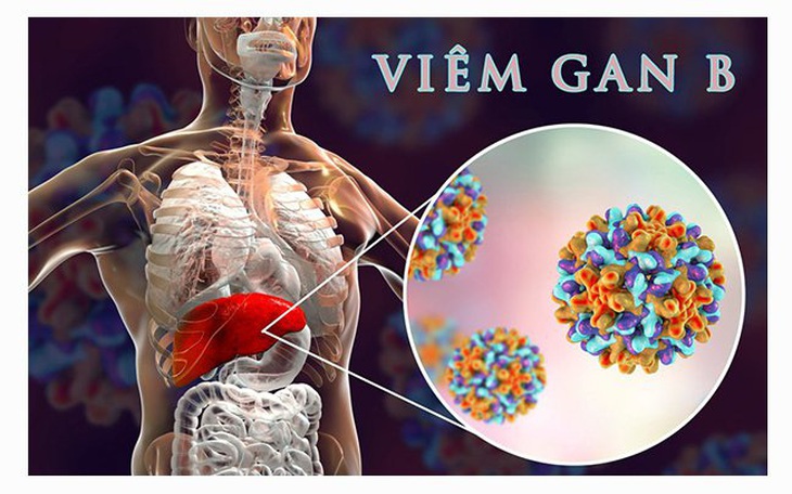 Viêm gan B: Nguyên nhân, triệu chứng và cách phòng bệnh hiệu quả