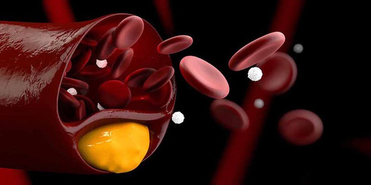 FDA phê duyệt thuốc để điều trị tăng cholesterol xấu ở trẻ em - Ảnh 1.