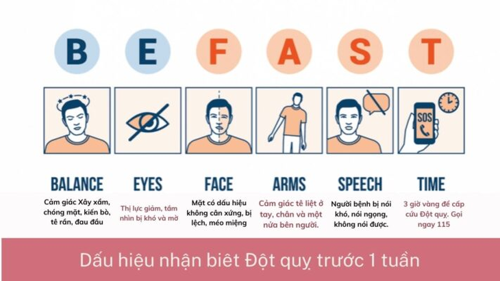 Trước FAST, đây là các dấu hiệu báo đột quỵ trước 1 tuần, 1 tháng - Ảnh 1.
