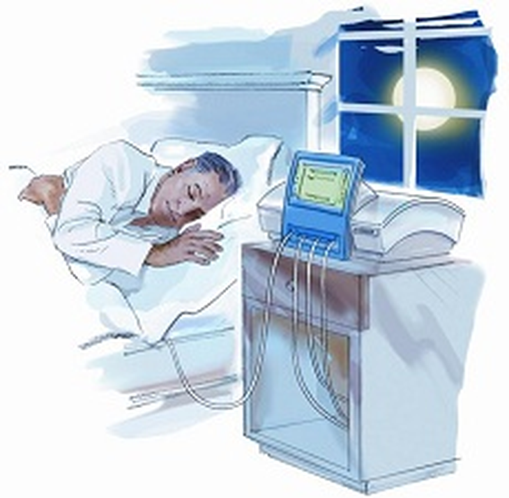 Lọc màng bụng - Giải pháp cho người suy thận mùa dịch? - Ảnh 3.