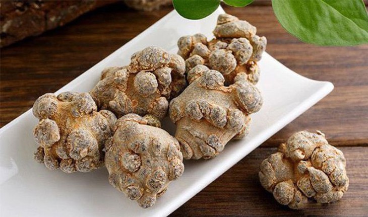 Không tự ý dùng thuốc đông y để chữa u xơ tử cung - Ảnh 1.