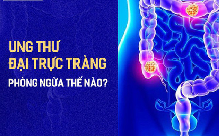 Ung thư đại trực tràng - Nguyên nhân, cách phát hiện và tầm soát