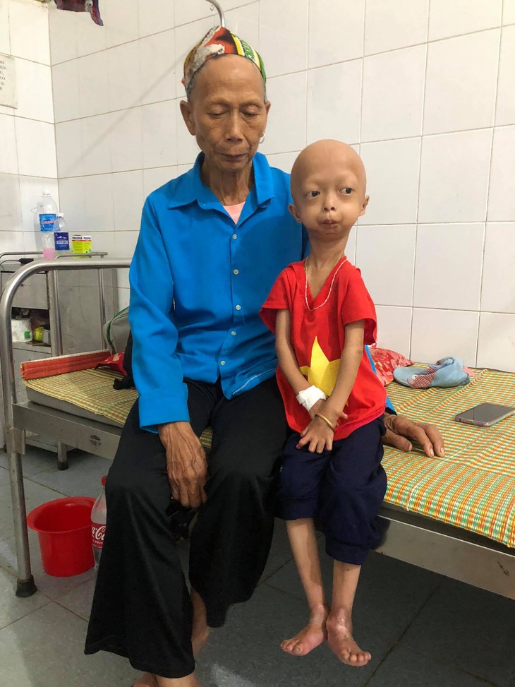 Xót xa bé gái dân tộc chân tay teo tóp, đầu không cọng tóc vì bệnh lạ không tiền điều trị - Ảnh 3. Xót xa bé gái dân tộc chân tay teo tóp, đầu không cọng tóc vì bệnh lạ không tiền điều trị - Ảnh 3.