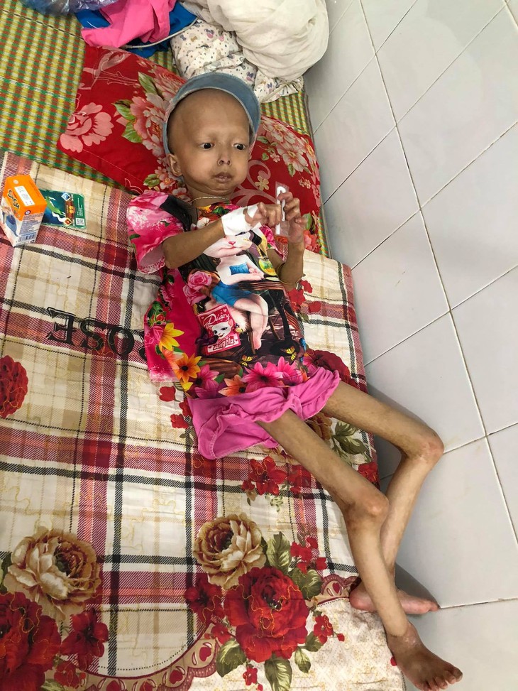 Xót xa bé gái dân tộc chân tay teo tóp, đầu không cọng tóc vì bệnh lạ không tiền điều trị - Ảnh 1. Xót xa bé gái dân tộc chân tay teo tóp, đầu không cọng tóc vì bệnh lạ không tiền điều trị - Ảnh 1.