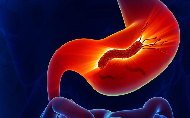 Nhiễm vi khuẩn Helicobacter pylori và nỗi lo ung thư dạ dày
