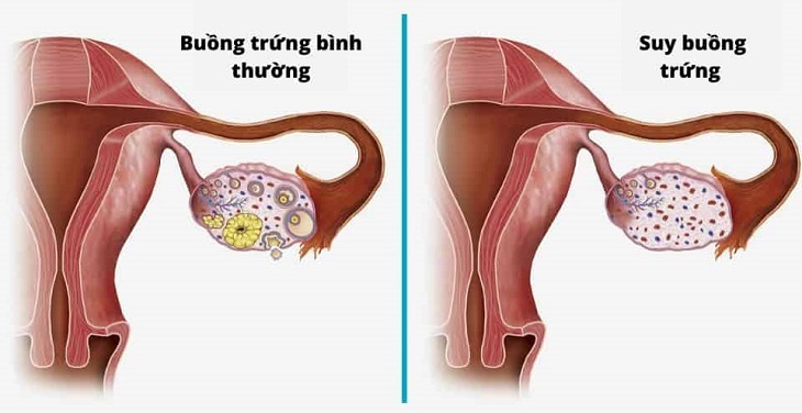 Phụ nữ phải 'chịu đựng' 11 triệu chứng mãn kinh trong mấy năm? - Ảnh 1.