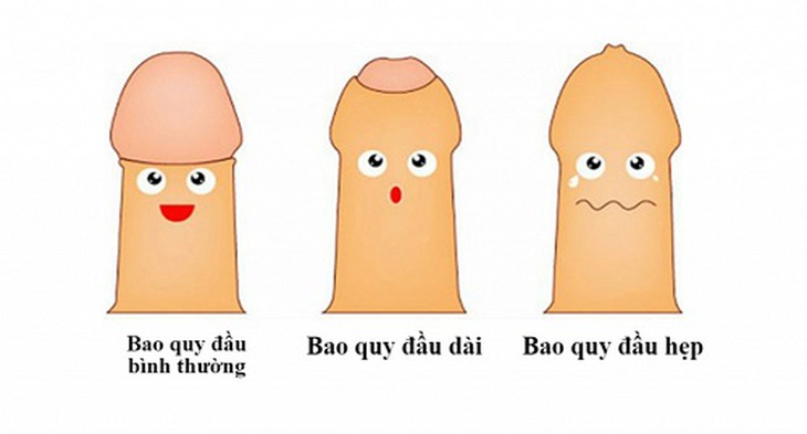 Nhiễm trùng nấm dương vật: Các triệu chứng, nguyên nhân và cách điều trị - Ảnh 5. Nhiễm trùng nấm dương vật: Các triệu chứng, nguyên nhân và cách điều trị - Ảnh 5.