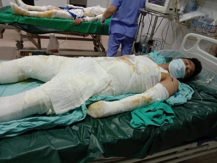 Hình ảnh mới của chàng trai nghèo bị bỏng điện cao thế - Ảnh 1. Hình ảnh mới của chàng trai nghèo bị bỏng điện cao thế - Ảnh 1.