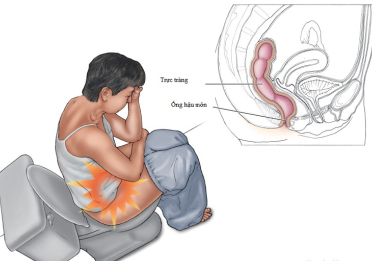 Ngồi nhiều - chứng bệnh “thời COVID-19” có thể hủy hoại bạn - Ảnh 9.