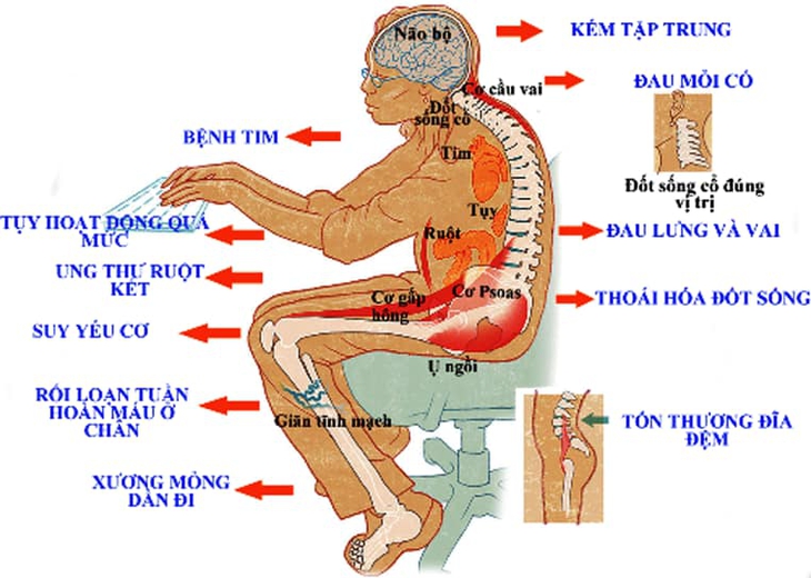 Ngồi nhiều - chứng bệnh “thời COVID-19” có thể hủy hoại bạn - Ảnh 5.
