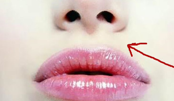  - Ảnh 3.