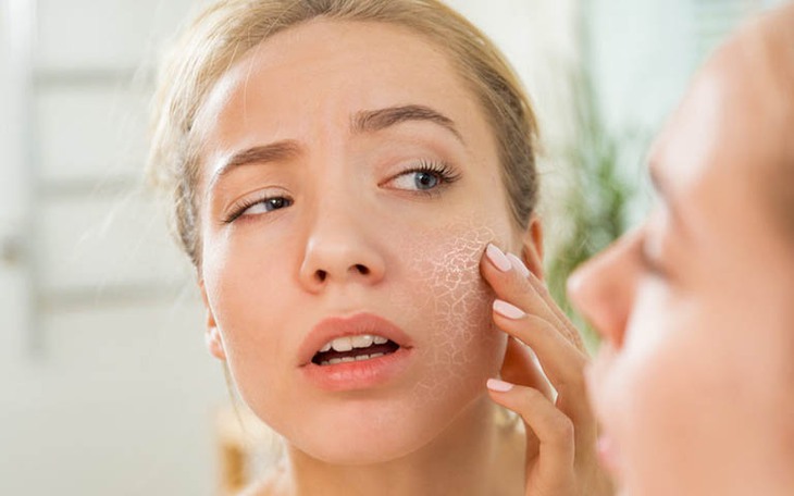 Da nứt nẻ mùa hanh khô phải làm sao? - Ảnh 3.