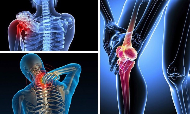 7 thói quen âm thầm tàn phá xương khớp khủng khiếp  - Ảnh 1.