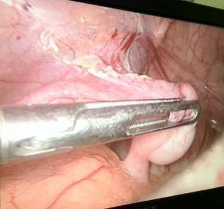 photo-1636955083794