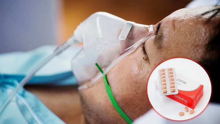 Nghiên cứu cho thấy thuốc statin không ngăn ngừa COVID-19 nghiêm trọng - Ảnh 1. Nghiên cứu cho thấy thuốc statin không ngăn ngừa COVID-19 nghiêm trọng - Ảnh 1.