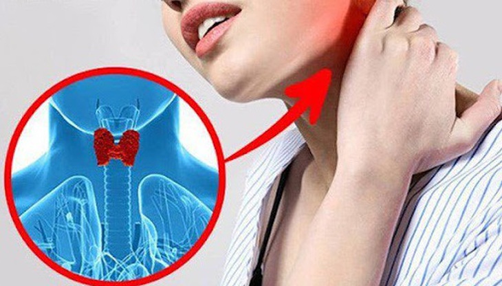 Ung thư tuyến giáp: Sự phát triển của khối u và chẩn đoán mô bệnh học - Ảnh 3.