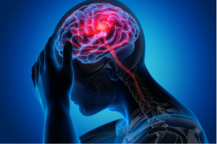 Những lầm tưởng phổ biến về bệnh tăng huyết áp - Ảnh 2.