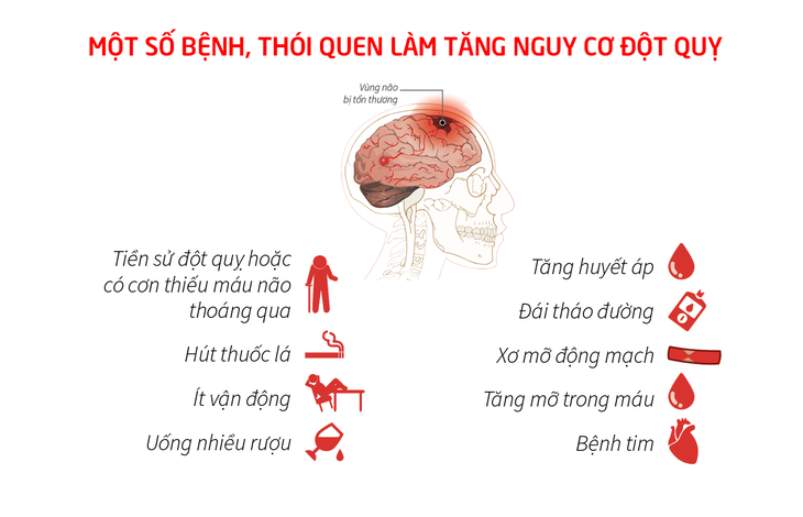 Hiểu các yếu tố nguy cơ đột quỵ để phòng ngừa sớm - Ảnh 2.