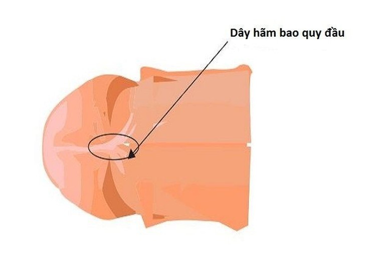 Cách xử trí nếu gặp phải tai nạn đối với “cậu nhỏ - Ảnh 5.