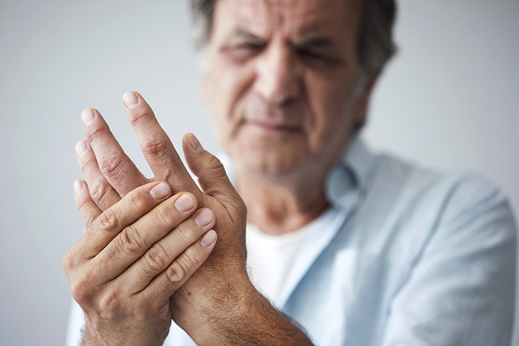 Viêm khớp dạng thấp: Nguyên nhân, triệu chứng và cách điều trị - Ảnh 3.