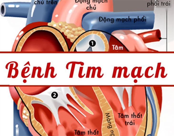 Một số yếu tố nguy cơ gây bệnh tim mạch mà ai cũng cần phải biết - Ảnh 2.