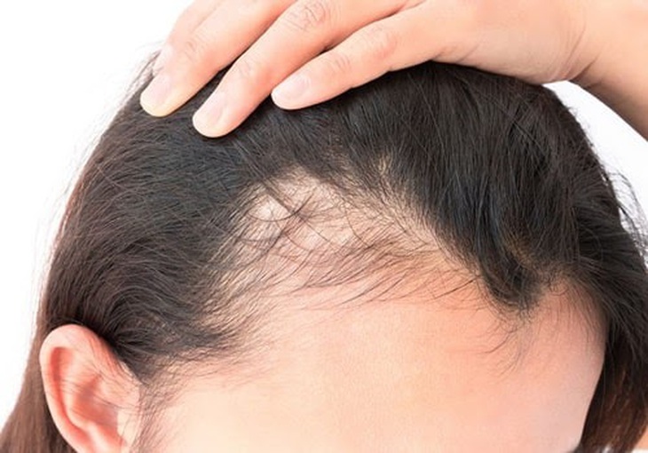 Tiết lộ bí quyết giúp tóc nhanh dài đơn giản chỉ bằng gừng dừa hữu cơ - Ảnh 1. Tiết lộ bí quyết giúp tóc nhanh dài đơn giản chỉ bằng gừng dừa hữu cơ - Ảnh 1.