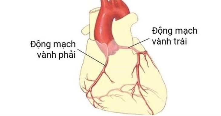 Bệnh động mạch vành và các yếu tố nguy cơ - Ảnh 3. Bệnh động mạch vành và các yếu tố nguy cơ - Ảnh 3.