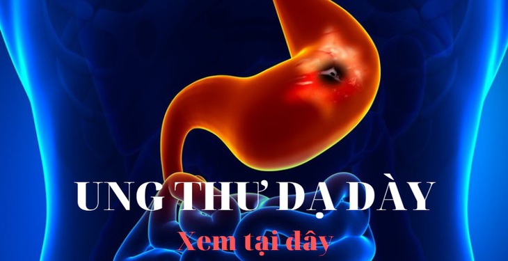 Ung thư dạ dày: Chẩn đoán và điều trị - Ảnh 1.