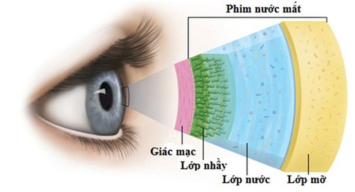 Vì sao khô mắt lại khó trị và lời khuyên của chuyên gia - Ảnh 3. Vì sao khô mắt lại khó trị và lời khuyên của chuyên gia - Ảnh 3.