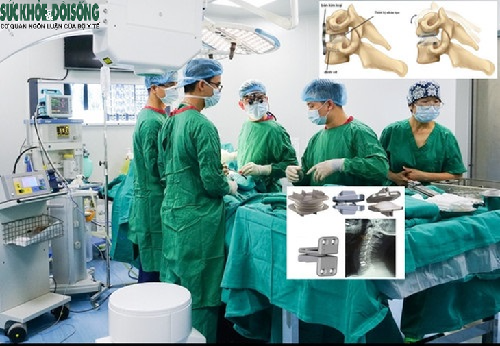 Các biến chứng sau phẫu thuật thay đĩa đệm nhân tạo cột sống cổ và cách chăm sóc - Ảnh 2.