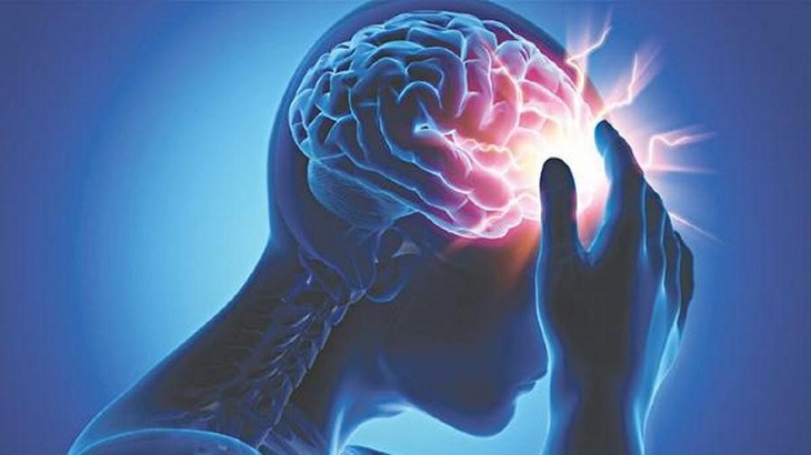 Điểm mặt nguyên nhân và các yếu tố nguy cơ gây nhồi máu não - Ảnh 1. Điểm mặt nguyên nhân và các yếu tố nguy cơ gây nhồi máu não - Ảnh 1.