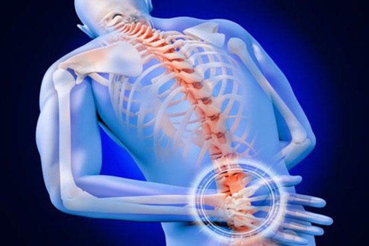 Viêm cột sống dính khớp: Triệu chứng, nguyên nhân và cách điều trị - Ảnh 4.