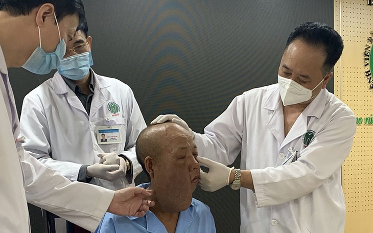 Phẫu thuật "bóc" khối u thần kinh lớn ở má khiến người đàn ông bị biến dạng cả khuôn mặt - Ảnh 1. Phẫu thuật "bóc" khối u thần kinh lớn ở má khiến người đàn ông bị biến dạng cả khuôn mặt - Ảnh 1.